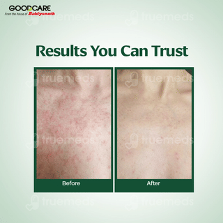 Baidyanath Goodcare Cold Pressed Neem Oil 100Ml